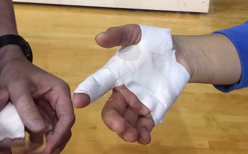 故意伤害轻伤怎么判刑？(图1)